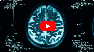 Vital Center Kroker Video zur Indikation Degenerative Erkrankungen des Gehirns und des Rückenmarks