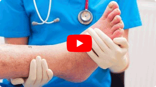 Vital Center Kroker Video zur Indikation Diabetisches Fußsyndrom